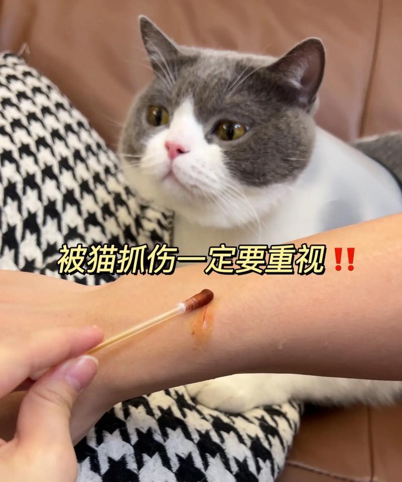 猫咪咬人的原因及应对方法（了解猫咪咬人的心理，预防伤害）