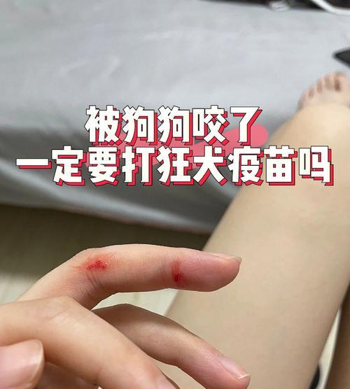 注射疫苗后狗狗的护理方法（狗狗疫苗注射后的护理指南）