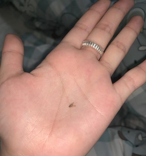 猫体内的常见寄生虫（揭开猫咪身上的小秘密）