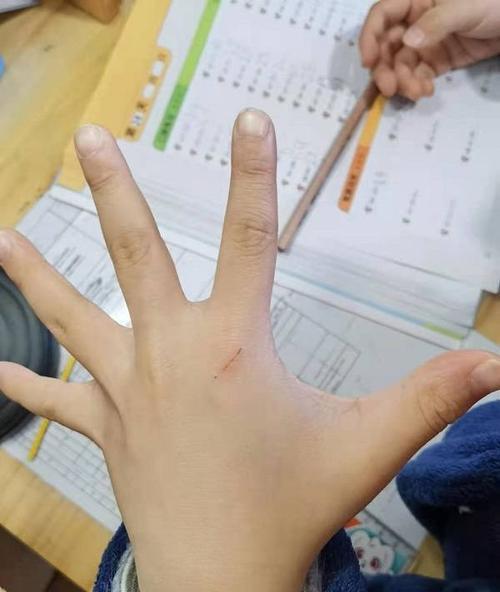 小猫抓痕（了解小猫抓痕的原因及应对措施）