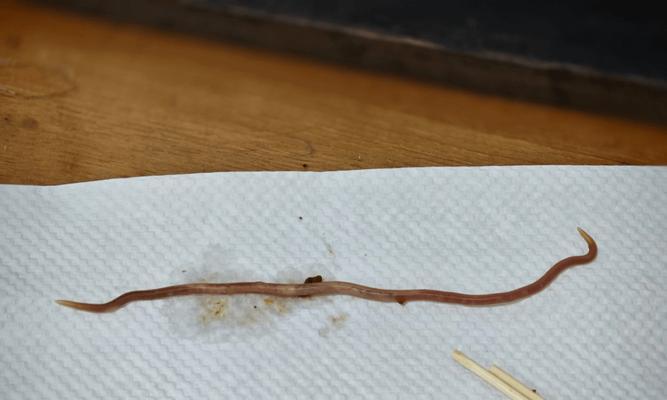 白色虫卵的奥秘——在屎里发现的微小生物（探索屎中微生物的生态环境和生命周期）